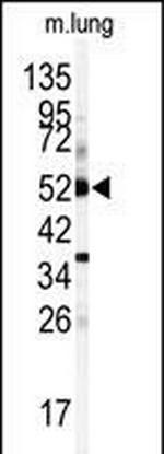 CYP1A1 Antibody in Western Blot (WB)