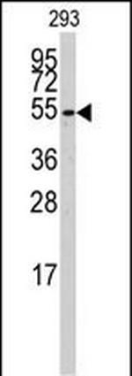 CYP26B1 Antibody in Western Blot (WB)