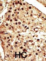 TRPM7 Antibody in Immunohistochemistry (Paraffin) (IHC (P))