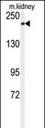 TRPM7 Antibody in Western Blot (WB)