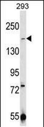 TRPM7 Antibody in Western Blot (WB)