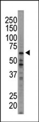 HRI Antibody in Western Blot (WB)