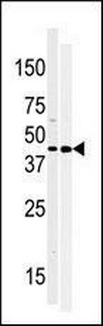 MOS Antibody in Western Blot (WB)