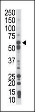 PCK1 Antibody in Western Blot (WB)