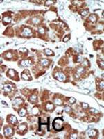 SIK1 Antibody in Immunohistochemistry (Paraffin) (IHC (P))