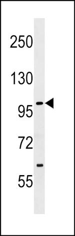 SIK1 Antibody in Western Blot (WB)