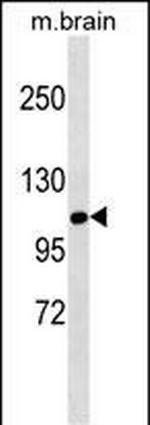 SIK1 Antibody in Western Blot (WB)