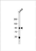 WEE1 Antibody in Western Blot (WB)