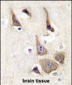 Adenylate Kinase 5 Antibody in Immunohistochemistry (Paraffin) (IHC (P))