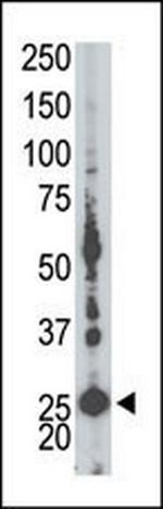 Adenylate Kinase 5 Antibody in Western Blot (WB)