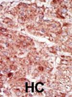 HK3 Antibody in Immunohistochemistry (Paraffin) (IHC (P))