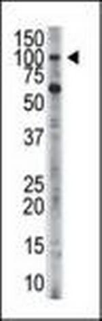 HK3 Antibody in Western Blot (WB)