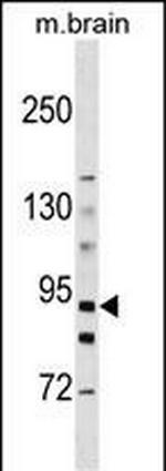 HK3 Antibody in Western Blot (WB)