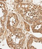 PFKFB4 Antibody in Immunohistochemistry (Paraffin) (IHC (P))