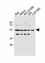 PFKFB4 Antibody in Western Blot (WB)