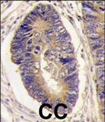 PTPN3 Antibody in Immunohistochemistry (Paraffin) (IHC (P))