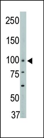 PTPN3 Antibody in Western Blot (WB)