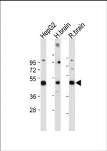 MKP3 Antibody in Western Blot (WB)