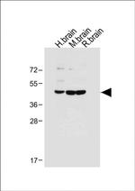 MKP3 Antibody in Western Blot (WB)