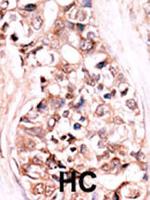 DUSP14 Antibody in Immunohistochemistry (Paraffin) (IHC (P))