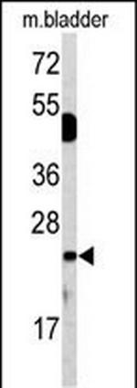 DUSP14 Antibody in Western Blot (WB)