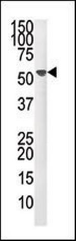 PPM1F Antibody in Western Blot (WB)