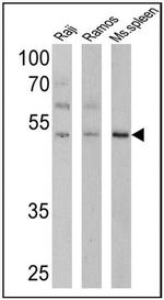 Human IgA (Heavy chain) Secondary Antibody in Western Blot (WB)