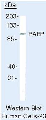 PARP1 Antibody in Western Blot (WB)