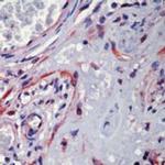 NFkB p65 Antibody in Immunohistochemistry (Paraffin) (IHC (P))