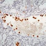 Myeloperoxidase Antibody in Immunohistochemistry (Paraffin) (IHC (P))