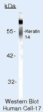 Cytokeratin 14 Antibody in Western Blot (WB)