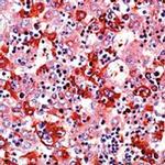 AFP Antibody in Immunohistochemistry (Paraffin) (IHC (P))