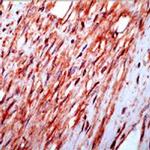 beta Actin Antibody in Immunohistochemistry (Paraffin) (IHC (P))