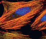 MYH9 Antibody in Immunocytochemistry (ICC/IF)