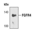 FGFR4 Antibody in Western Blot (WB)