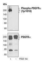 Phospho-PDGFRA (Tyr1018) Antibody in Western Blot (WB)