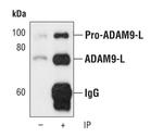 ADAM9 Antibody in Immunoprecipitation (IP)