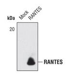 CCL5 (RANTES) Antibody in Western Blot (WB)