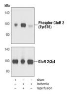 Phospho-GluR2 (Tyr876) Antibody in Western Blot (WB)