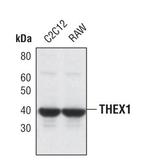 ERI1 Antibody in Western Blot (WB)