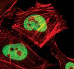 CTCF Antibody in Immunocytochemistry (ICC/IF)