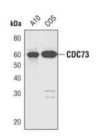 Cdc73 Antibody in Western Blot (WB)