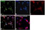 JMJD1B Antibody in Immunocytochemistry (ICC/IF)