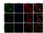 JMJD1B Antibody in Immunocytochemistry (ICC/IF)