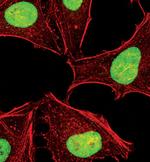 JMJD1B Antibody in Immunocytochemistry (ICC/IF)