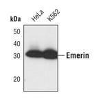 Emerin Antibody in Western Blot (WB)