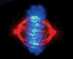 INCENP Antibody in Immunocytochemistry (ICC/IF)