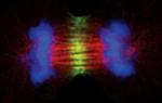 INCENP Antibody in Immunocytochemistry (ICC/IF)