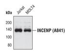 INCENP Antibody in Western Blot (WB)