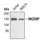 INCENP Antibody in Western Blot (WB)